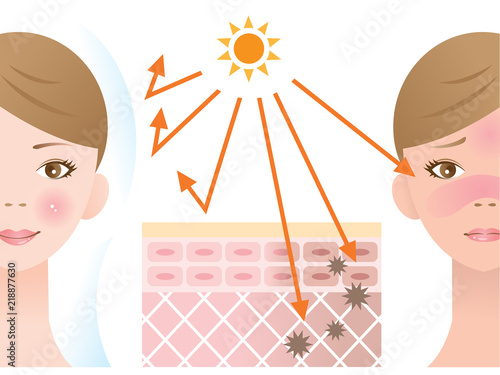 紫外線対策　女性