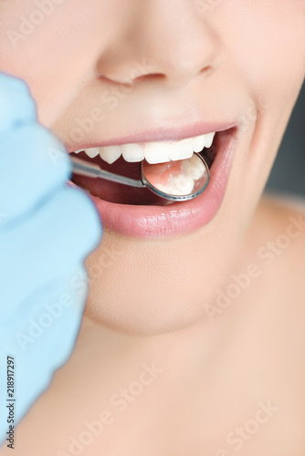 partial view of dentist with dental mirror checking womans teeth