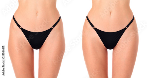Closeup shot of female thighs before and after treatment  isolated on white background