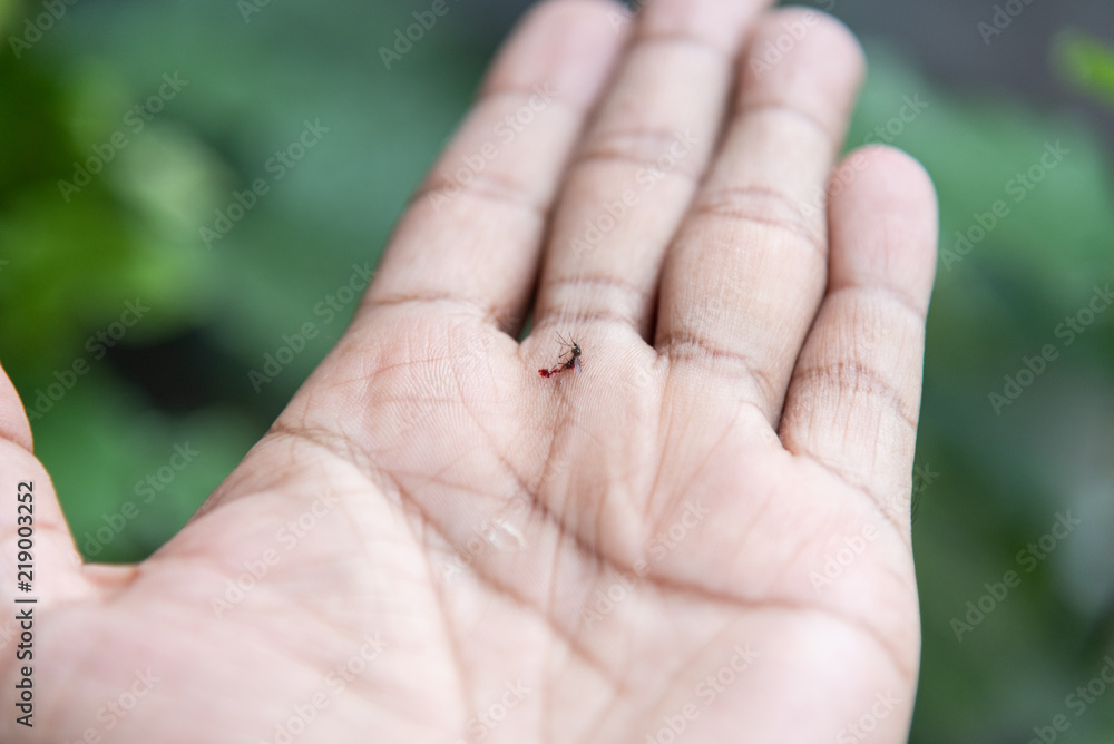 Close Up Mosquito dead body on human hand Insect bite mosquito bite Close Up Mosquito dead body on human hand Insect bite mosquito bite