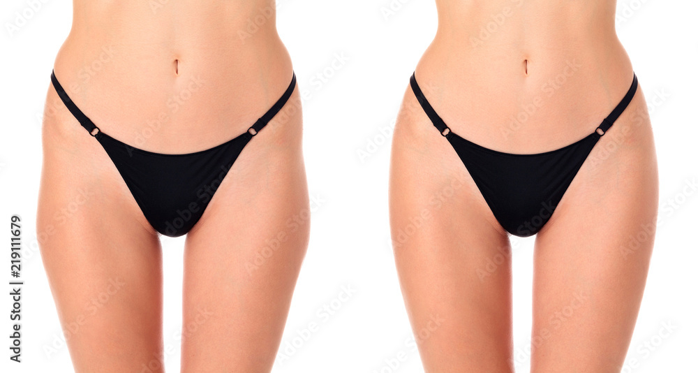 Closeup shot of female thighs before and after treatment, isolated on white background