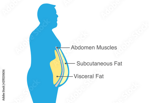 Location of Visceral fat stored within the abdominal cavity. Illustration about medical diagram.