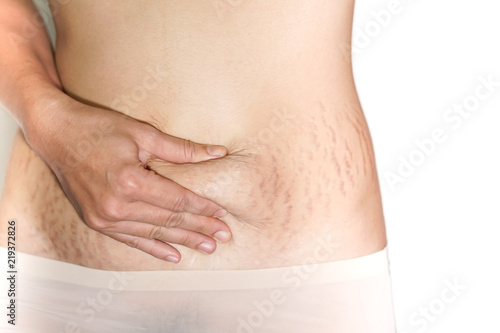Abdominal scar marked pattern