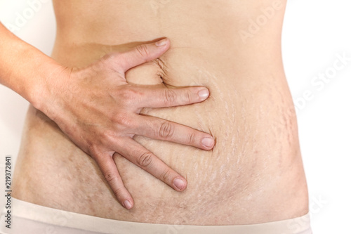 Abdominal scar marked pattern