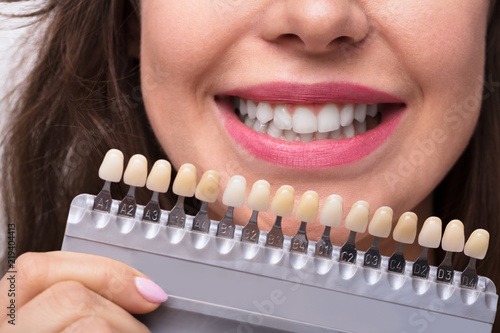 Woman Holding Set Of Implants With Various Shades Of Tone