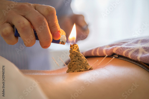 Konstfotografi Moxibustion