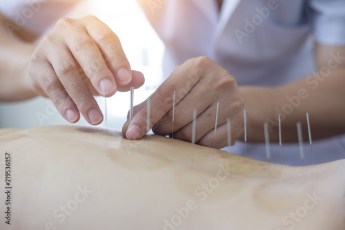 Traditional Chinese Medicine Treatment - Acupuncture