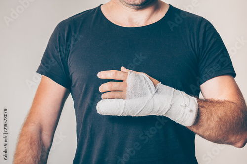 Plastered hand with fracture of the fifth metacarpal bone photo