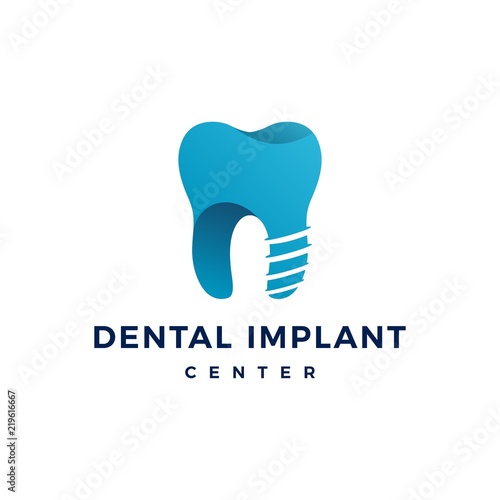 dental implant logo teeth tooth vector icon