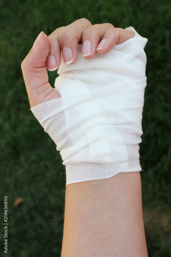 Stockfoto Injured hand bandaged up in gauze. Woman s hand. Pain