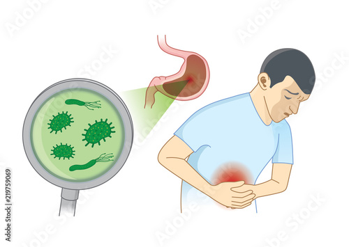 Man Suffering from stomach ache symptom because bacterial. Concept Illustration about hygiene and health.