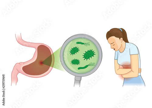 Woman suffering from stomach pain symptom because bacterial. Concept Illustration about hygiene and health.
