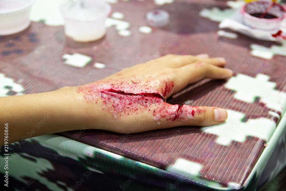 The fake wound on the hand for the boy, Dress the wound special effect by professional - obrazy, fototapety, plakaty 