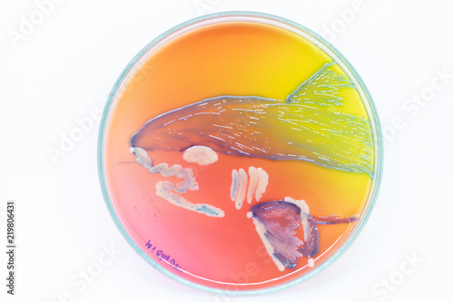 Backgrounds Artistic of Lactobacillus bulgaricus from laboratory microbiology. photo