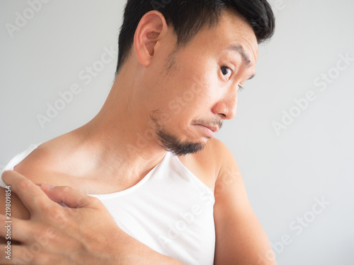 Asian man get tanned on the shoulder