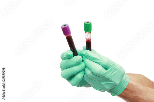 Hand with latex glove holding blood sample