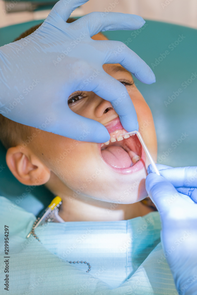 Naklejka premium Dentist examining boy's teeth in clinic. A small patient in the dental chair smiles. Dantist treats teeth. close up view of dentist treating teeth of little boy in dentist office. vertical photo.