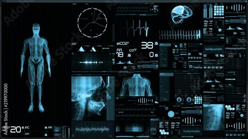Blue futuristic patient monitor screen in perspective / Medical screen interface. Screen with various parameters measured. ST-segment and heart attack detection, pace-maker analysis, and arrhythmia an