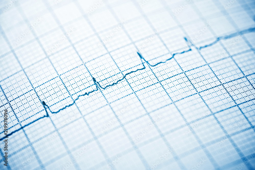 Electrocardiogram close up Electrocardiogram close up