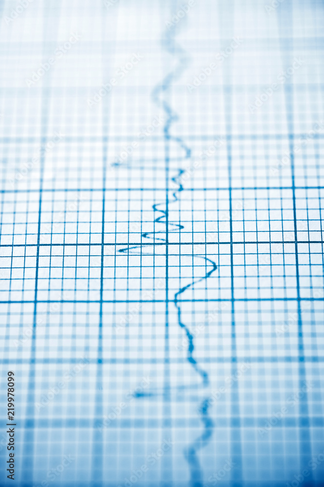 Electrocardiogram close up Electrocardiogram close up