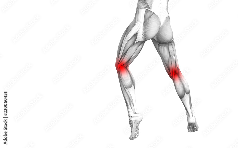 Conceptual knee human anatomy with red hot spot inflammation or articular joint pain for leg health care therapy or sport muscle concepts. 3D illustration man arthritis or bone osteoporosis disease Conceptual knee human anatomy with red hot spot inflammation or articular joint pain for leg health care therapy or sport muscle concepts. 3D illustration man arthritis or bone osteoporosis disease
