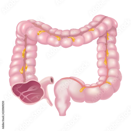 The large intestine, also called the colon, is part of the final stages of digestion