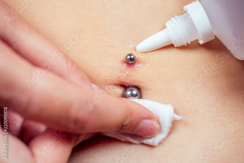 Canvas Print close-up hand holds cotton wool and disinfected antiseptic a drop on navel piercing