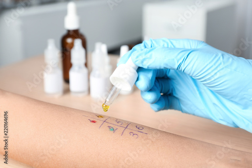 Doctor making allergy test at table, closeup photo