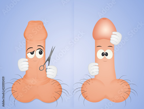 before and after circumcision photo