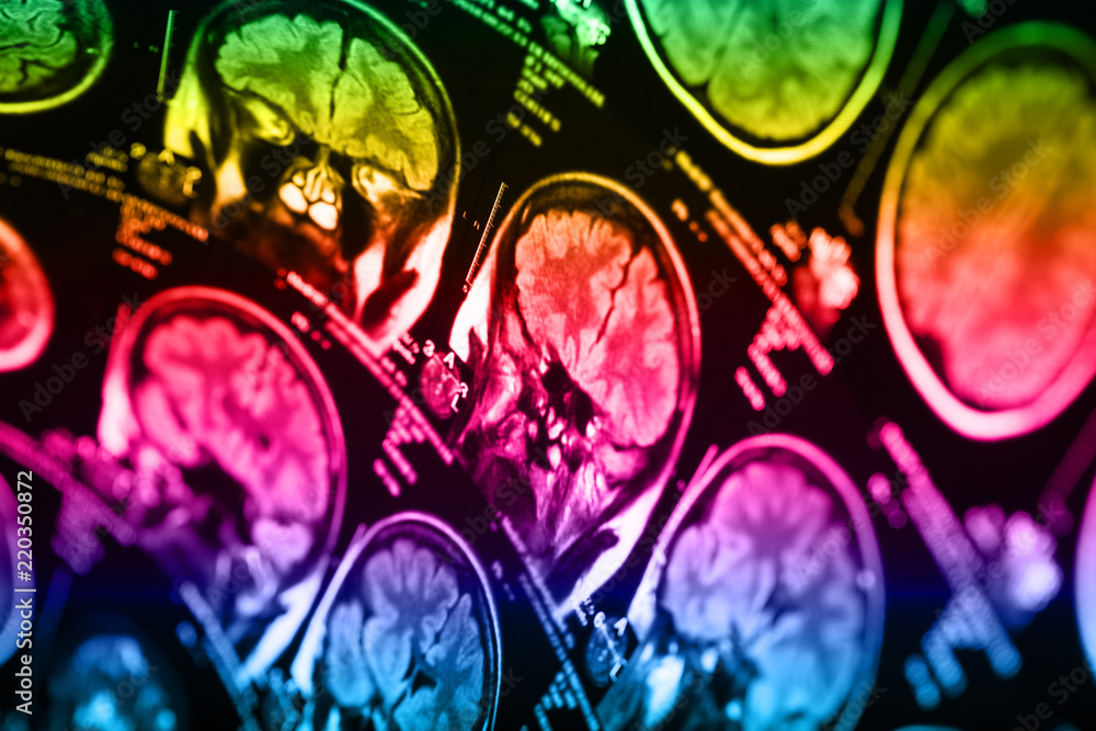 Obraz premium The X-ray of the human brain