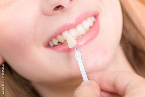 Farbe für Zahnersatz wird am Mund einer Patientin abgeglichen