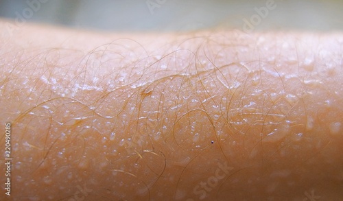Sweat droplets on human skin in hot weather close up