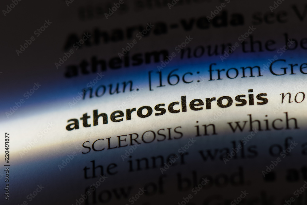 atherosclerosis