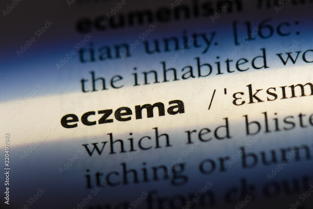  eczema