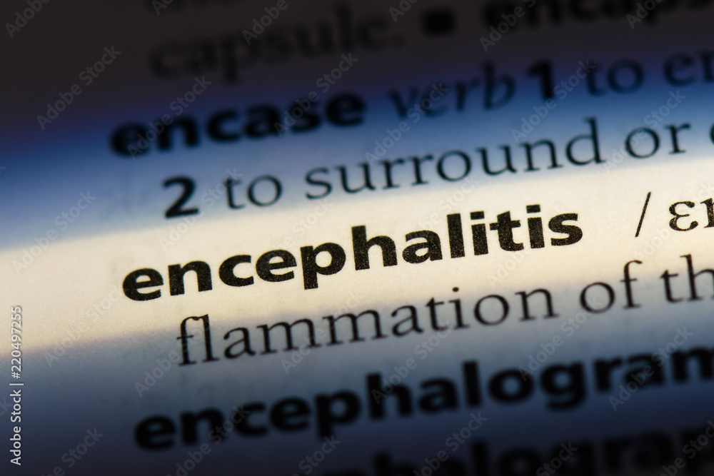 Obraz premium encephalitis