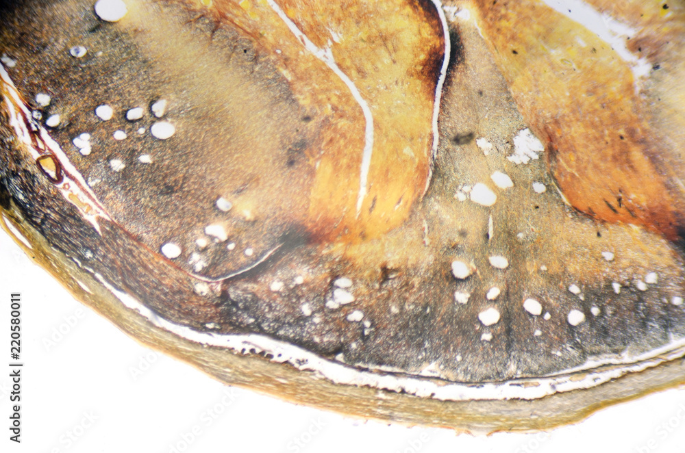 Microscope photography. Spinal cord, cross section. Microscope photography. Spinal cord, cross section.