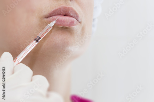 young woman gets injection in her lips. Woman in beauty salon. plastic surgery clinic.