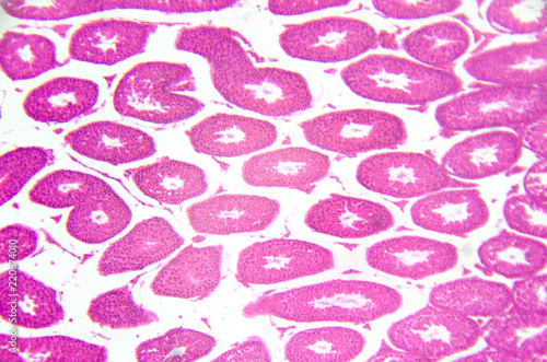 Microscopy photography. Testis, seminiferous tubules, cross section. photo