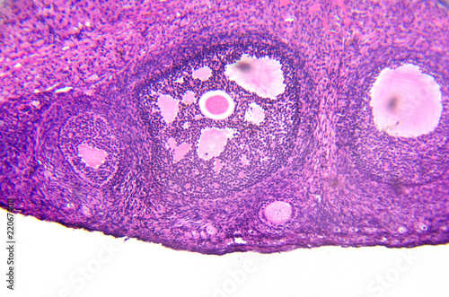 micrograph of ovary showing primordial, primary and secondary follicles isolated on white background. photo