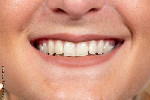 Close up smile with white teeth