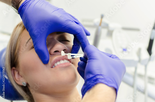 Woman on teeth bleaching at dentist