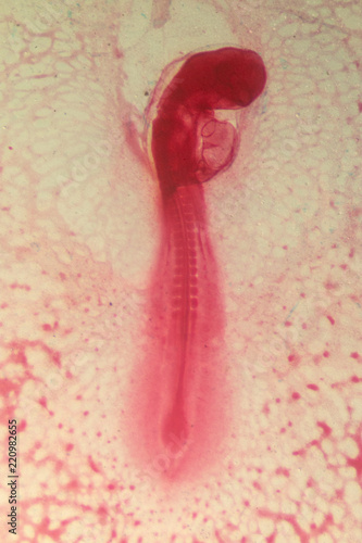 Development of the embryo chicken,The development of the chick on the slide under microscope. photo