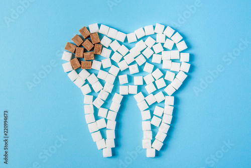 Sugar destroys the tooth enamel and leads to tooth decay. Tooth made of white and caries made of brown sugar cubes.