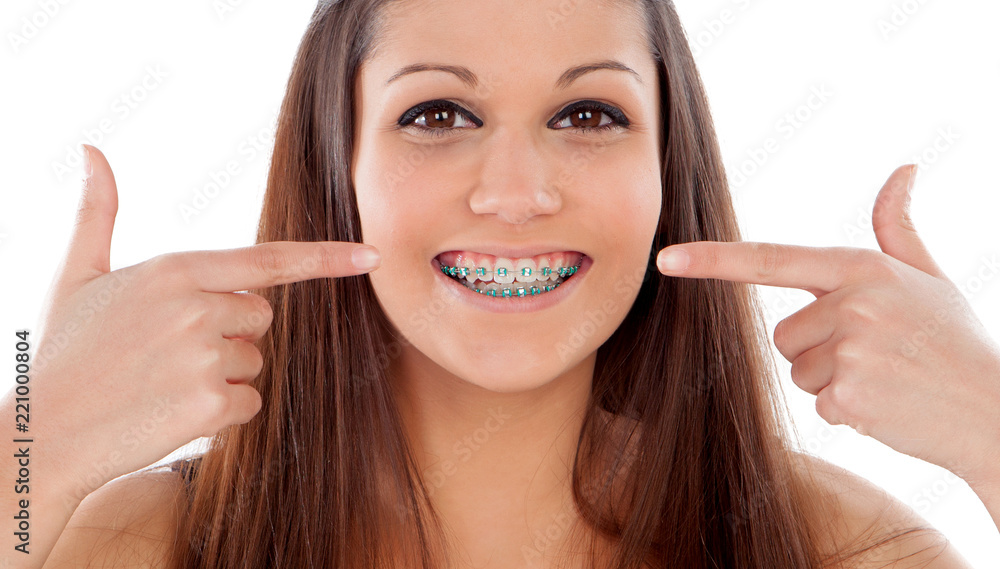Beautiful portrait of a young girl with brackets Beautiful portrait of a young girl with brackets