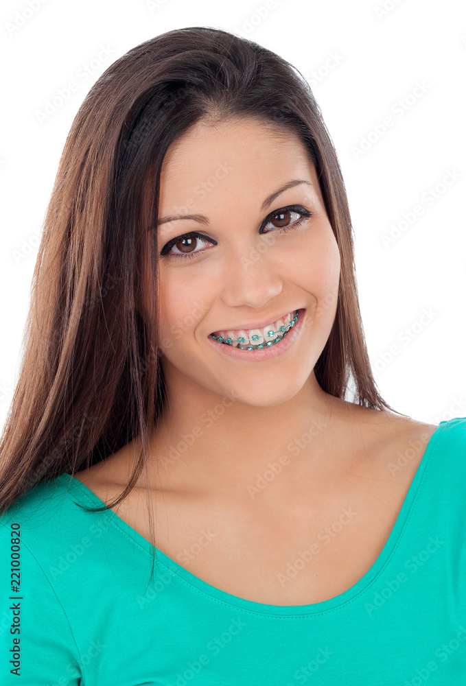 Beautiful portrait of a young girl with brackets Beautiful portrait of a young girl with brackets