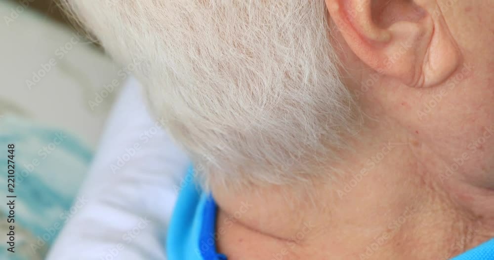Female chemotheraphy patient hair close up Female chemotheraphy patient hair close up