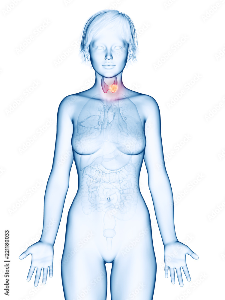 Fototapeta premium medically accurate 3d rendering of a female´s thyroid gland cancer