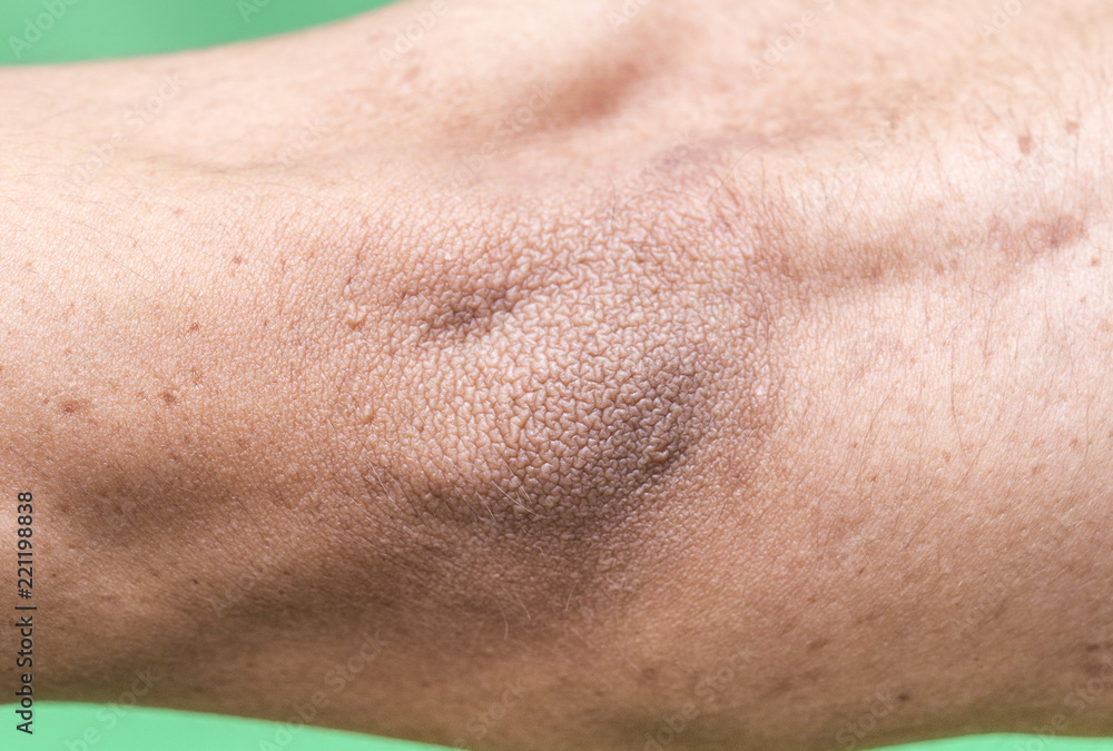Fototapeta premium hand, elbow male macro
