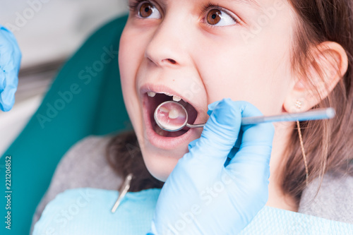 Treatment of teeth close-up. Children s dentistry