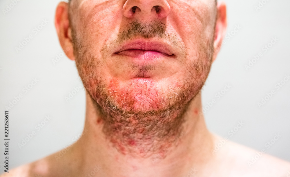 Detail of man